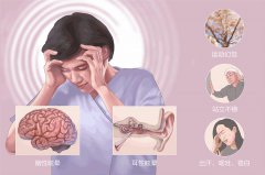 眩暈癥需要手術(shù)嗎?成都仁品耳鼻喉醫(yī)院解答
